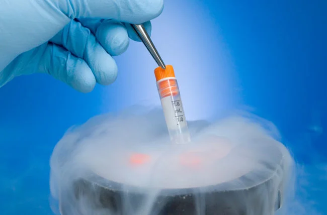 Read more about the article Fertility preservation: When should you freeze your eggs?